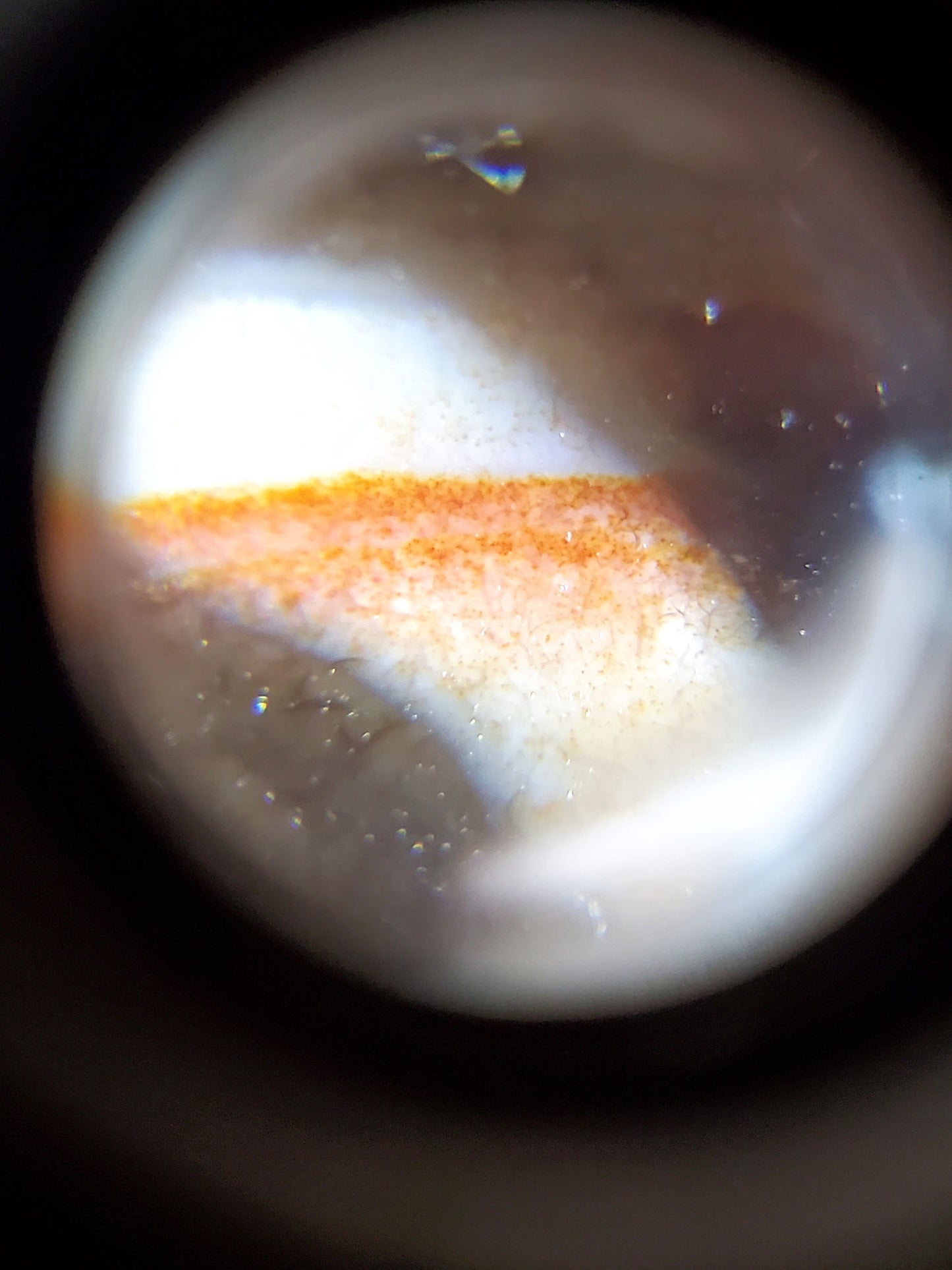 At-092823-6EBS3 microscope eye boundary rust-orange cinnabar granular accumulation dzi unretouched