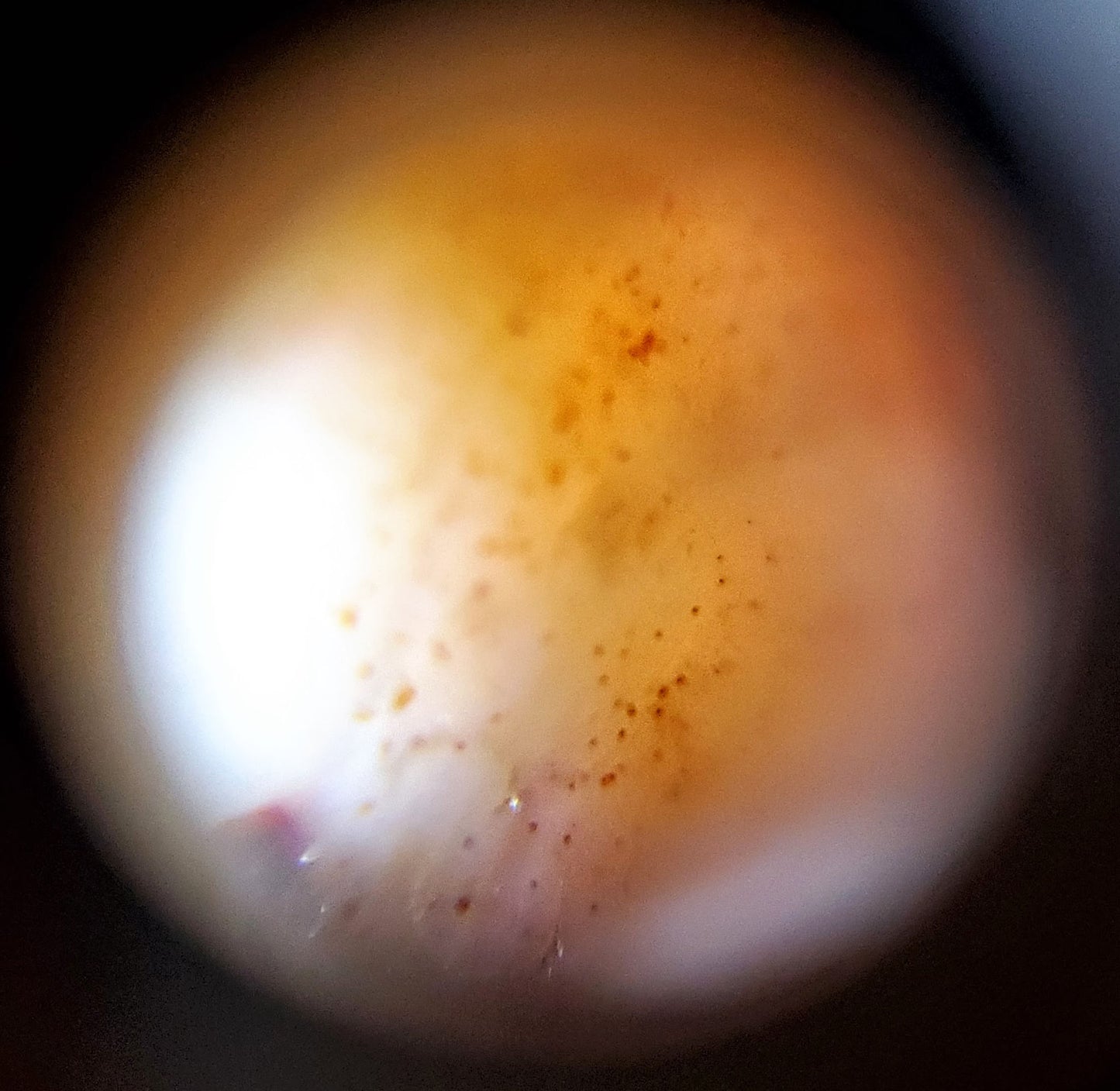 Macro view of Tasso dzi bead showing layered orange-red and white agate banding with bloodspot detail, At-052526-TaBS